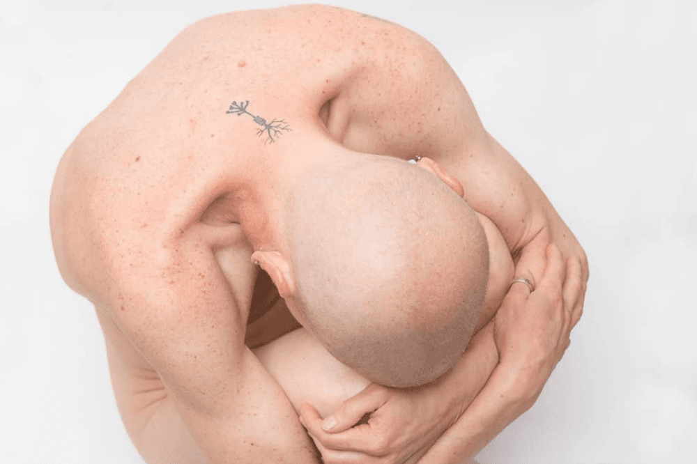 El cáncer de mama y los cuerpos que resisten