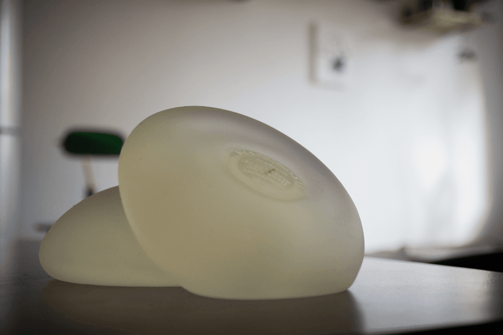 Nada es para siempre: cirugías estéticas y la fijación con el cuerpo